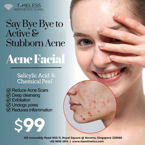 ✨ Say Bye-Bye to Active & Stubborn Acne ✨
Struggling with breakouts that just won’t go away?
Our Acne Facial combines Salicylic Acid & Chemical Peel to target acne at its root — for only $99! 💆‍♀
💖 Benefits you’ll love:
✅ Reduce acne scars
✅ Deep cleansing for clear, fresh skin
✅ Gentle exfoliation for smoother texture
✅ Unclogs pores & removes impurities
✅ Calms redness & reduces inflammation
📍 Exclusively at Timeless Aesthetics Clinic
📅 Limited-time offer — book now & enjoy your journey to clear, conf